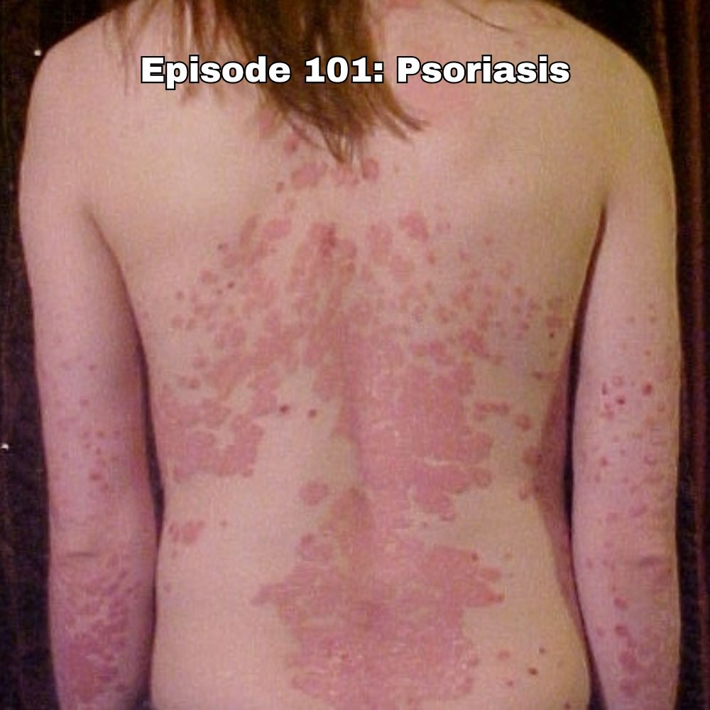 Episode 101: Psoriasis | Skin, Immunity, And The Marks We Carry