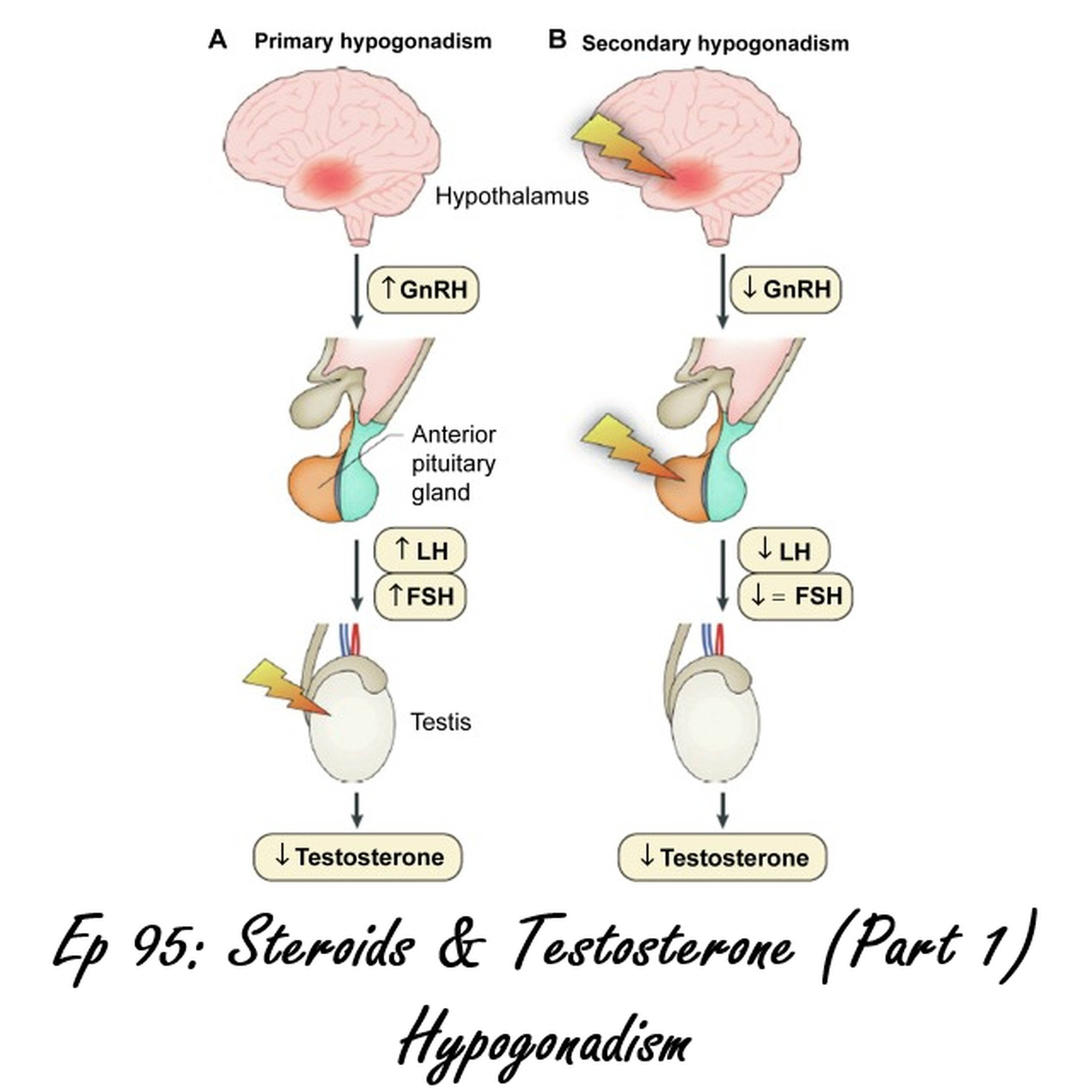 Episode 95: Steroids & Testosterone (Part 1) | Male Hypogonadism episode artwork