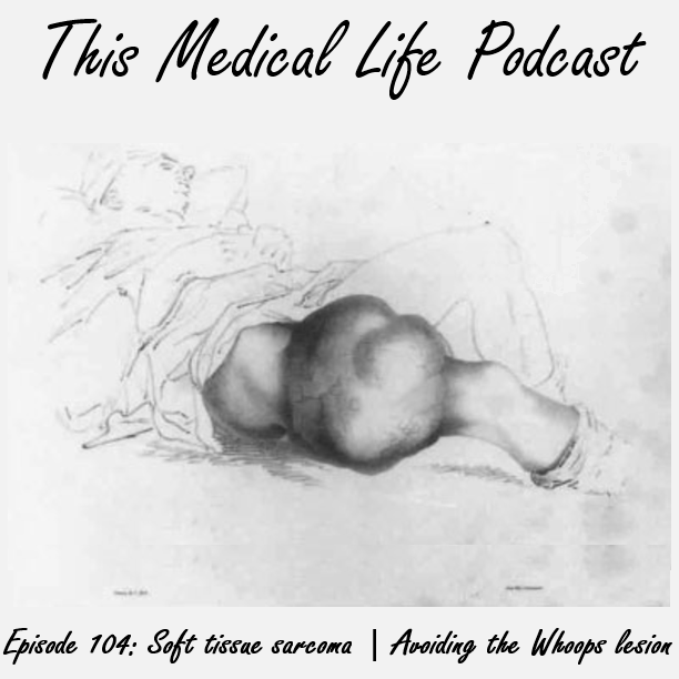Episode 104: Soft Tissue Sarcoma Part 1 | Avoiding The Whoops Lesion