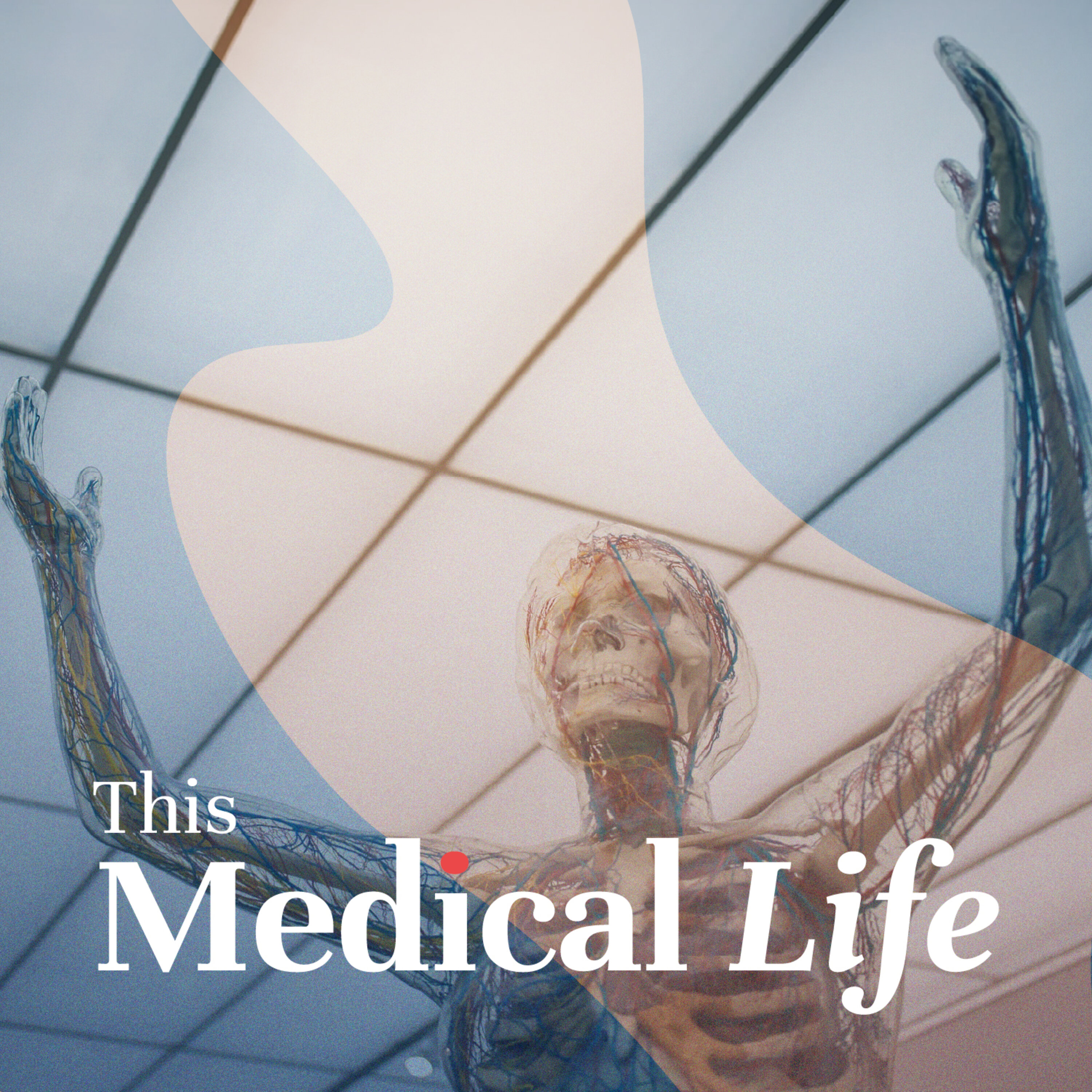 Episode 3: Systemic Lupus Erythematosus (SLE) | Alphabet Antibodies