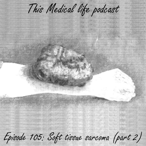 Episode 105: Soft Tissue Sarcoma Part 2 | Adjuvant Therapies