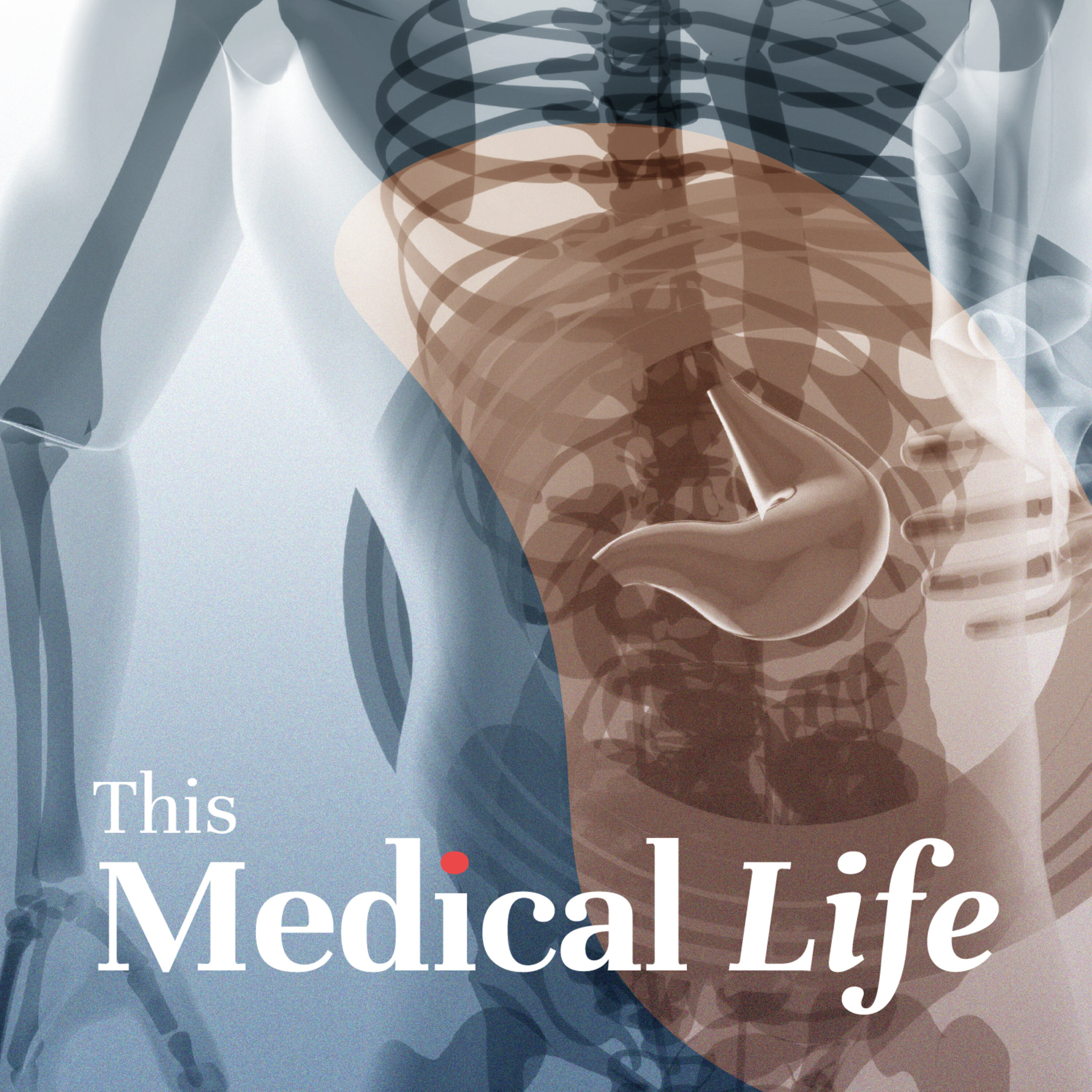 Episode 26: Crohn’s Disease & Ulcerative Colitis | The Complete Guide to IBD (Inflammatory Bowel Disease)