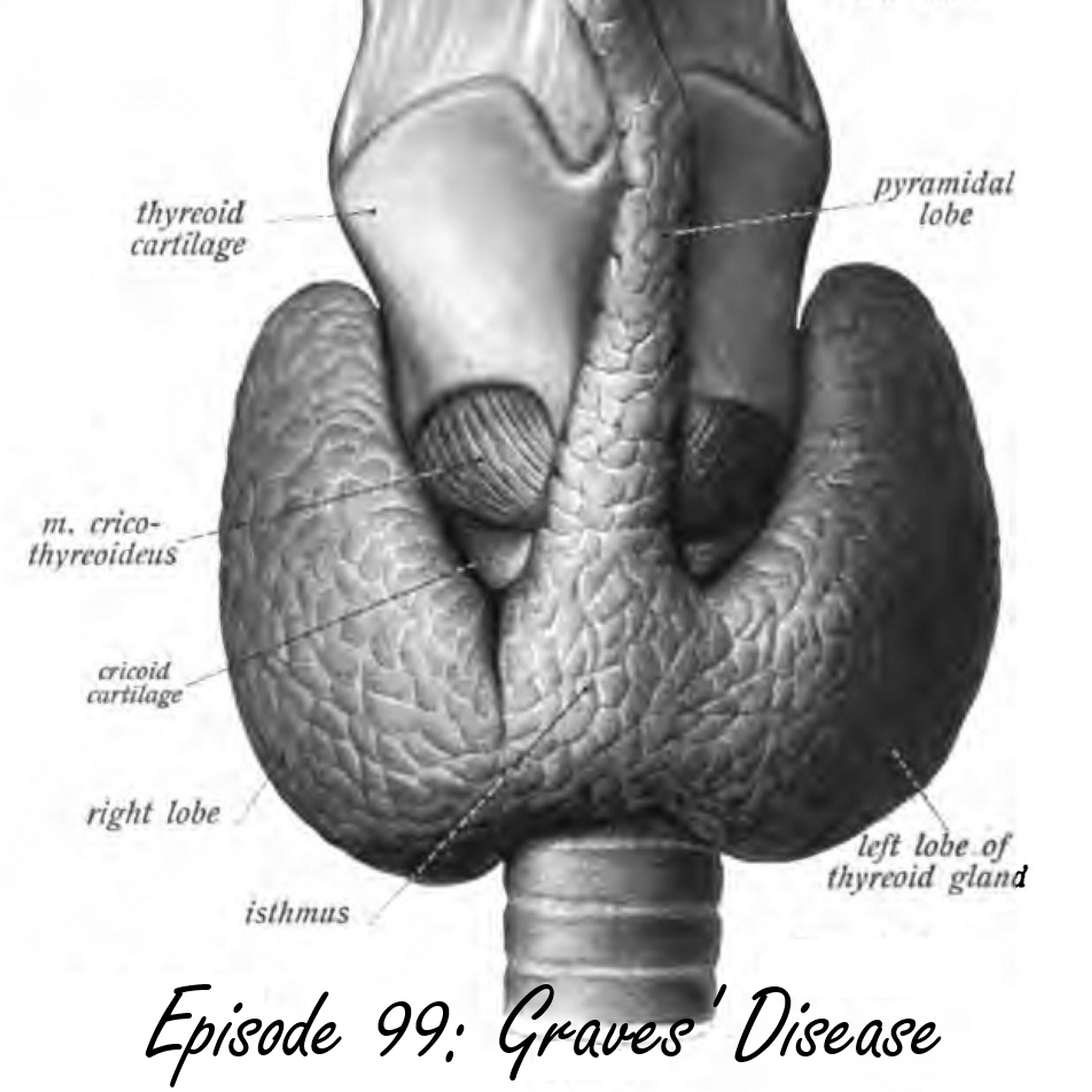 Episode 99: Graves’ Disease | Hyperthyroidism & Thyrotoxicosis episode artwork