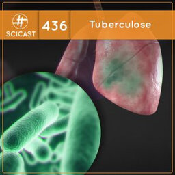 Tuberculose (SciCast #436)
