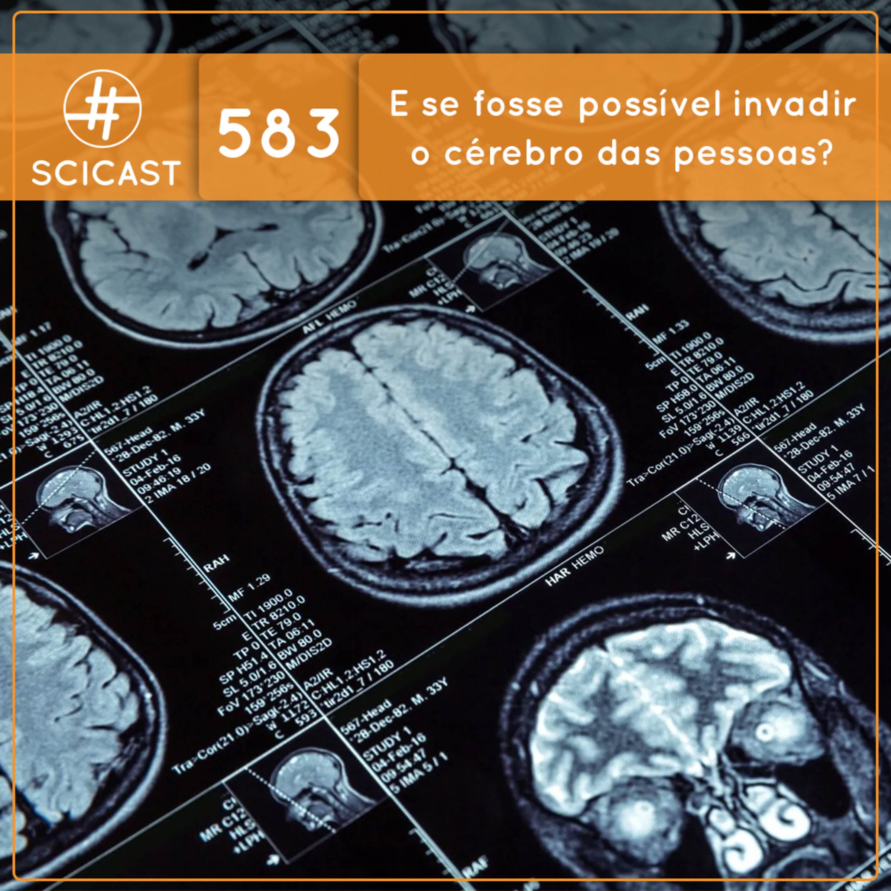 E se fosse possível invadir o cérebro das pessoas? (SciCast #583)