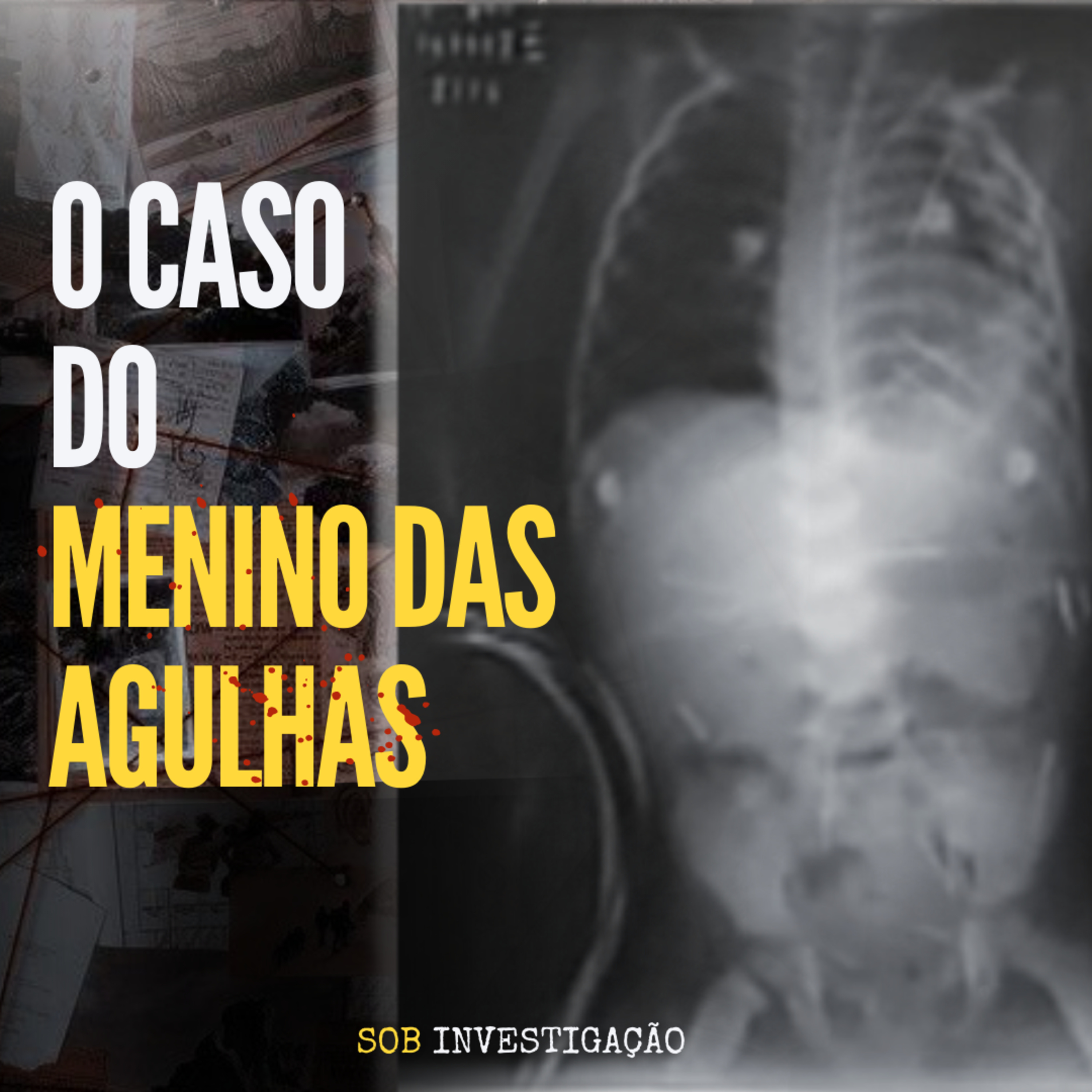 T02 Ep15 O caso do Menino das Agulhas