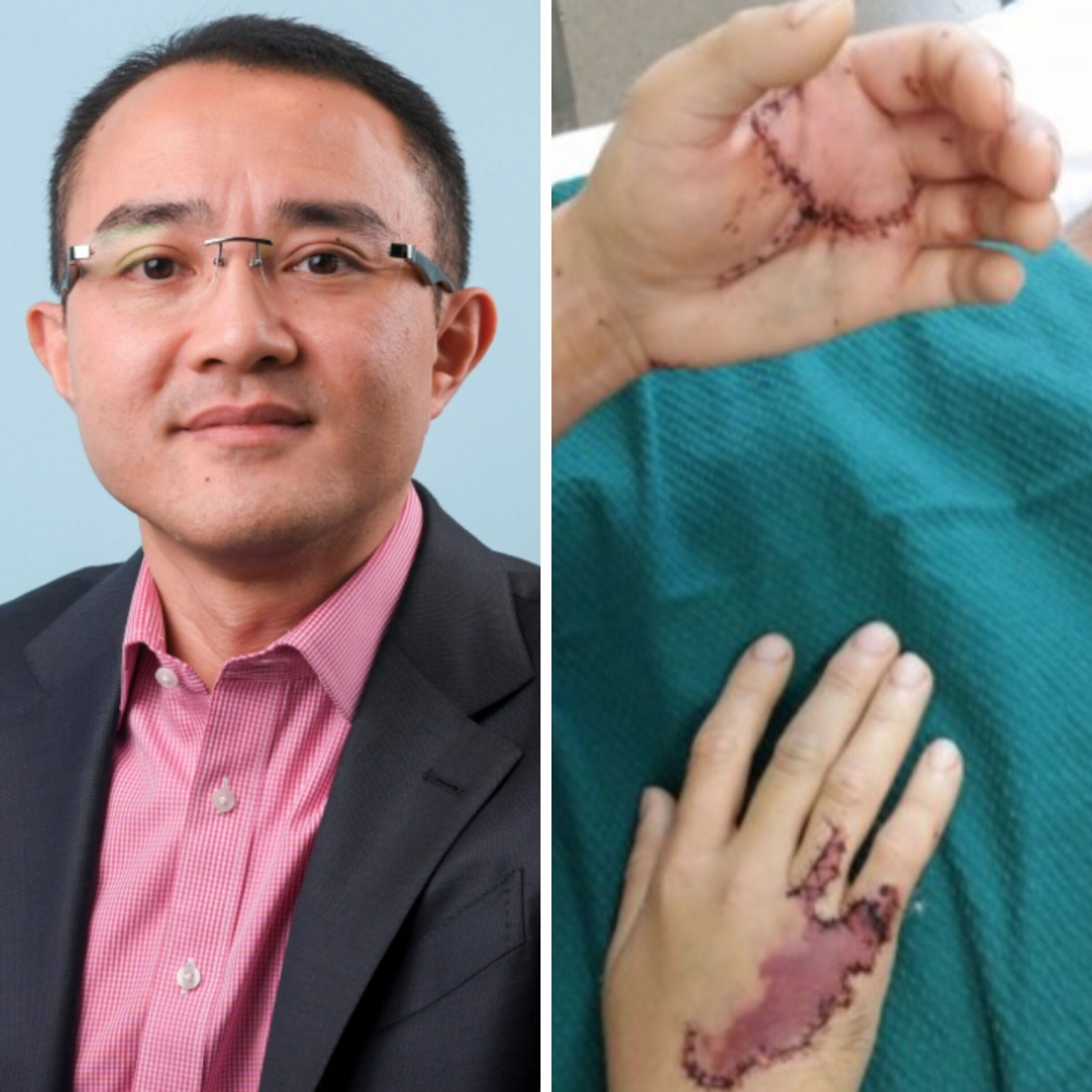 Stabbed 14 times in the hospital!