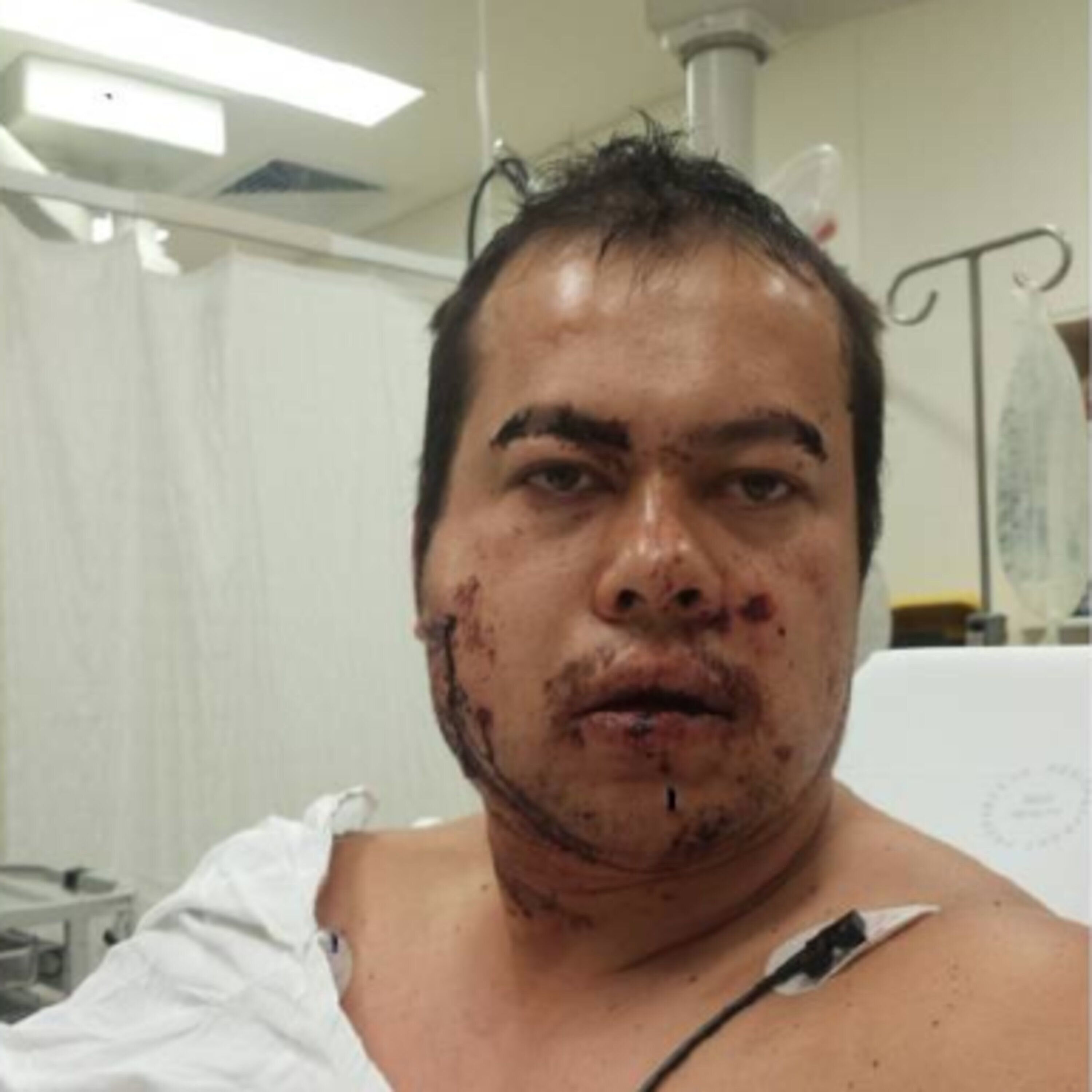"I was shot in the face by a stranger"
