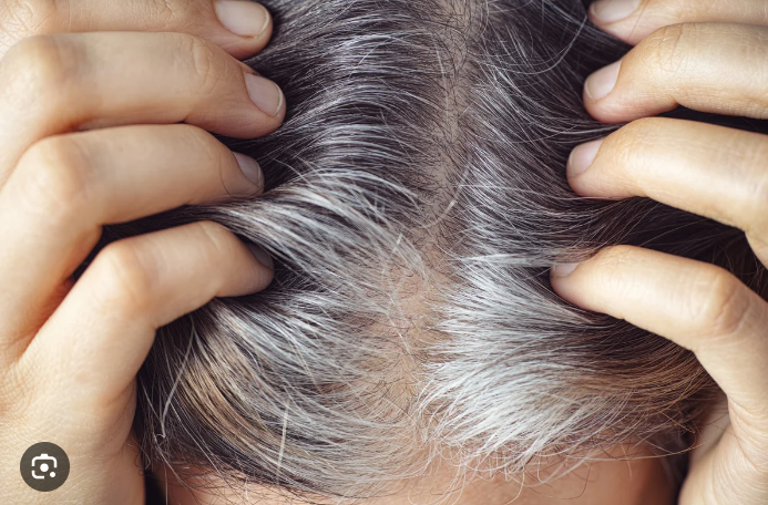 Number One Tip to STOP Grey Hair REVEALED