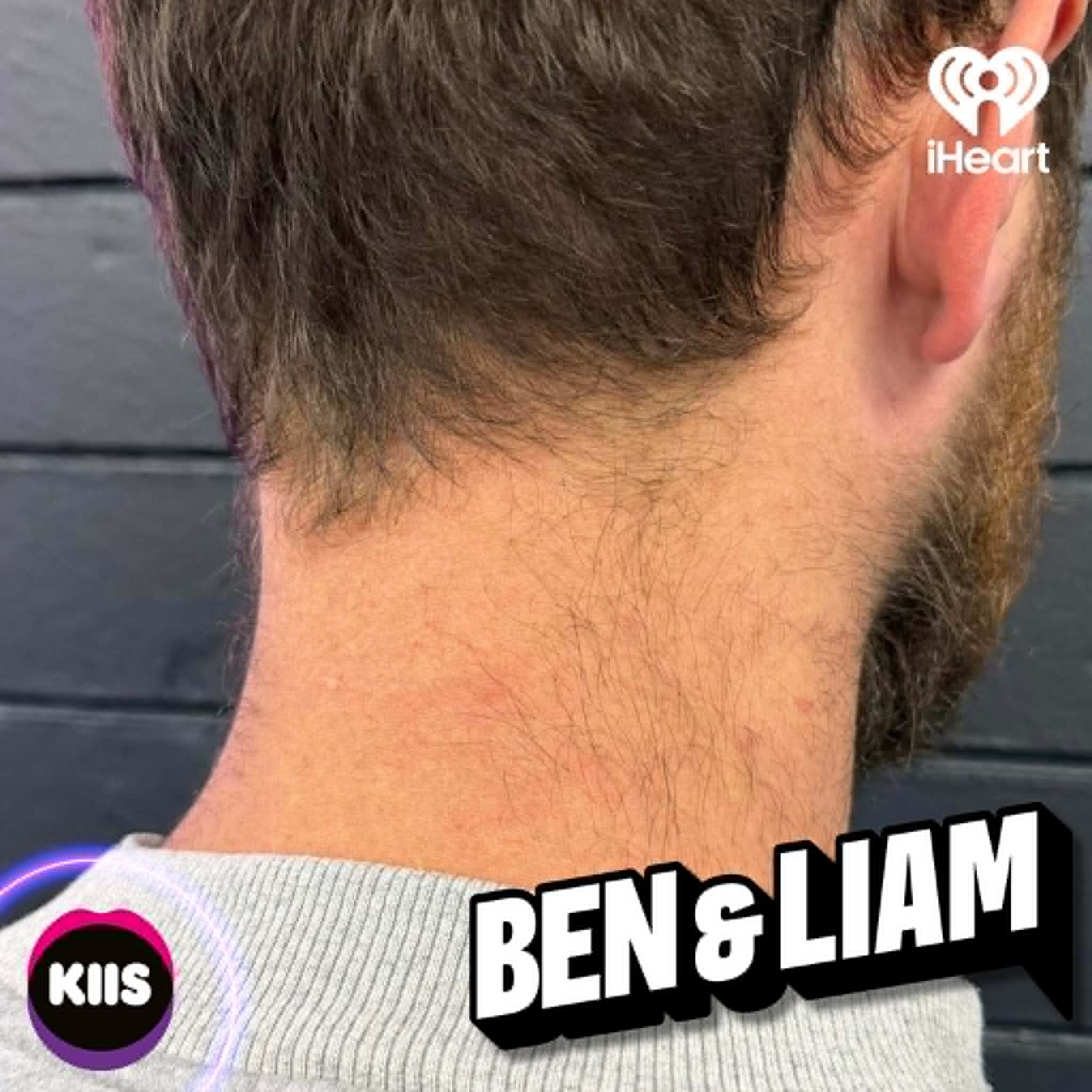 Ep 49: Ben’s neck hair episode artwork