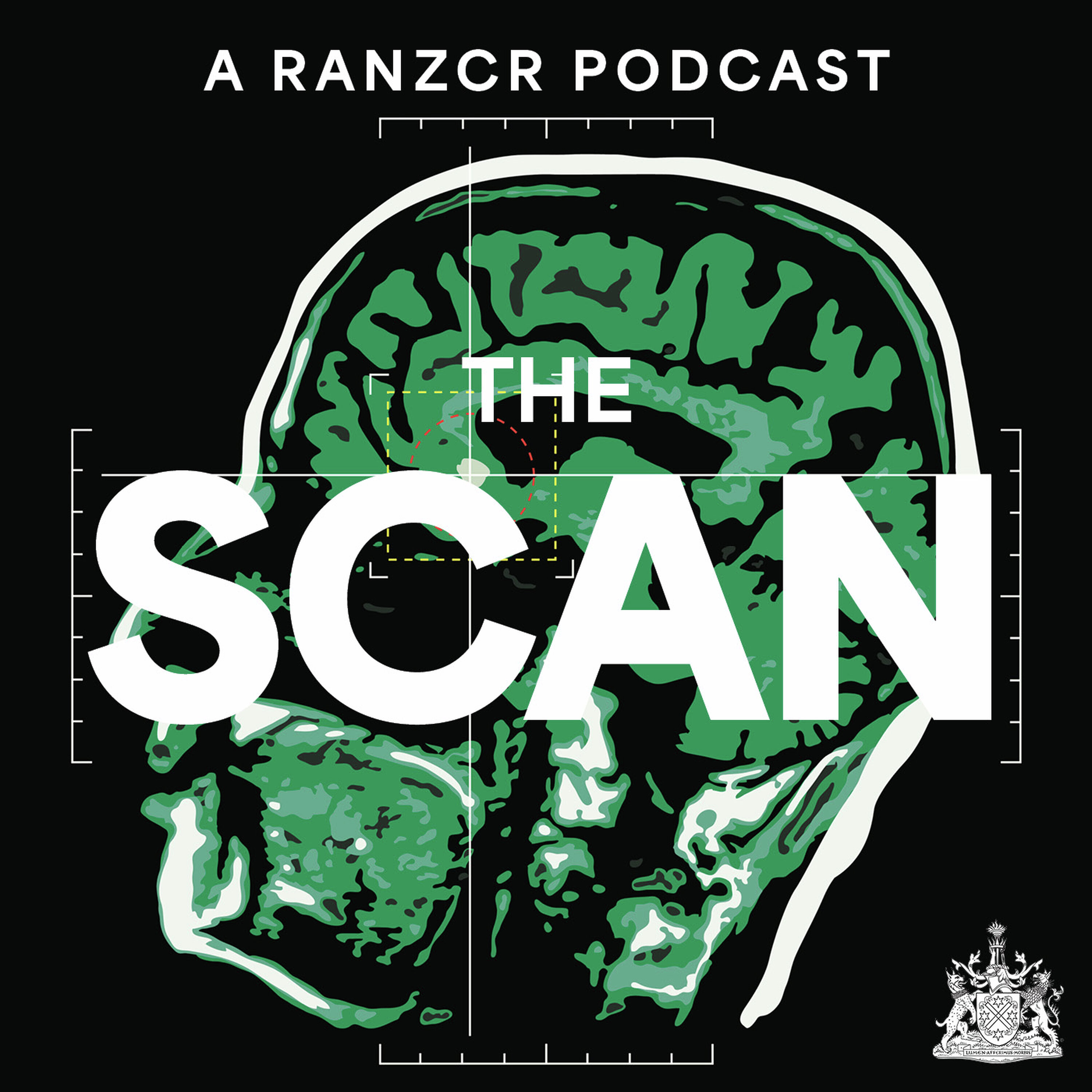 The Scan