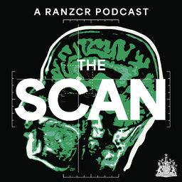 The Scan
